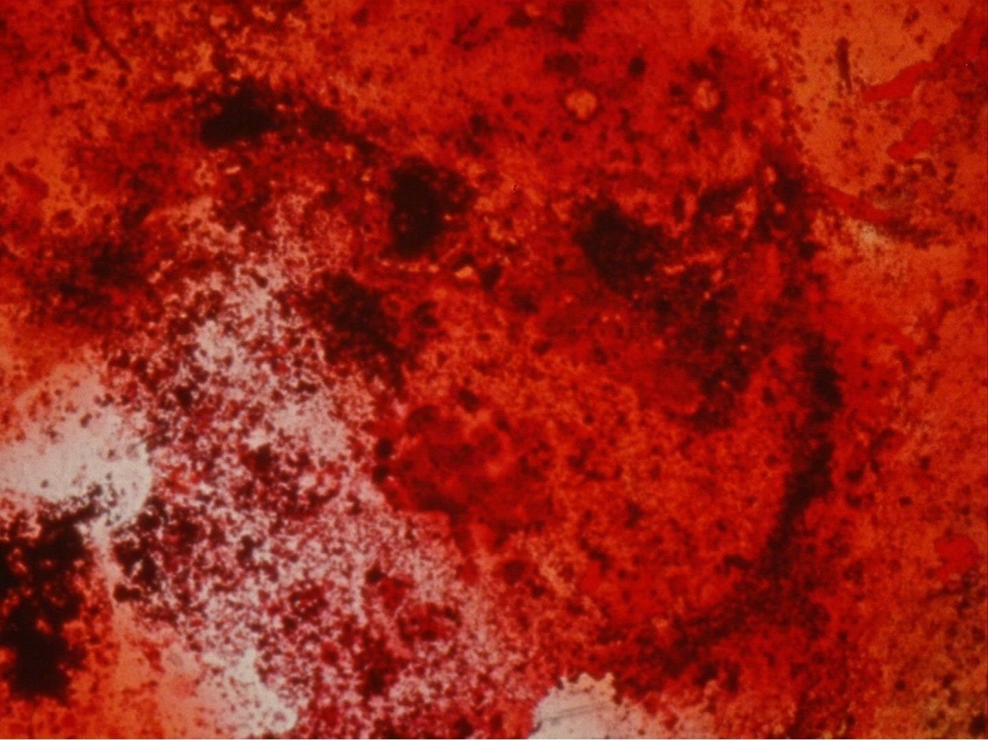 Brakhage